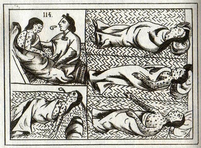 मैक्सिको में चेचक का इतिहास History of smallpox in Mexico