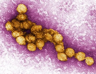 वेस्ट नाइल वायरस West Nile virus