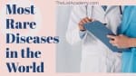 Cover Image For List : 177 Most Rarest Diseases In The World